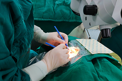 白内障的手术过程