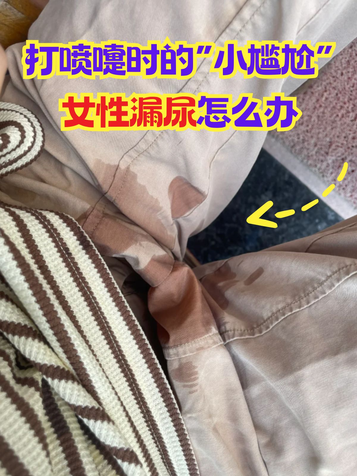 一咳嗽漏尿是什么原因