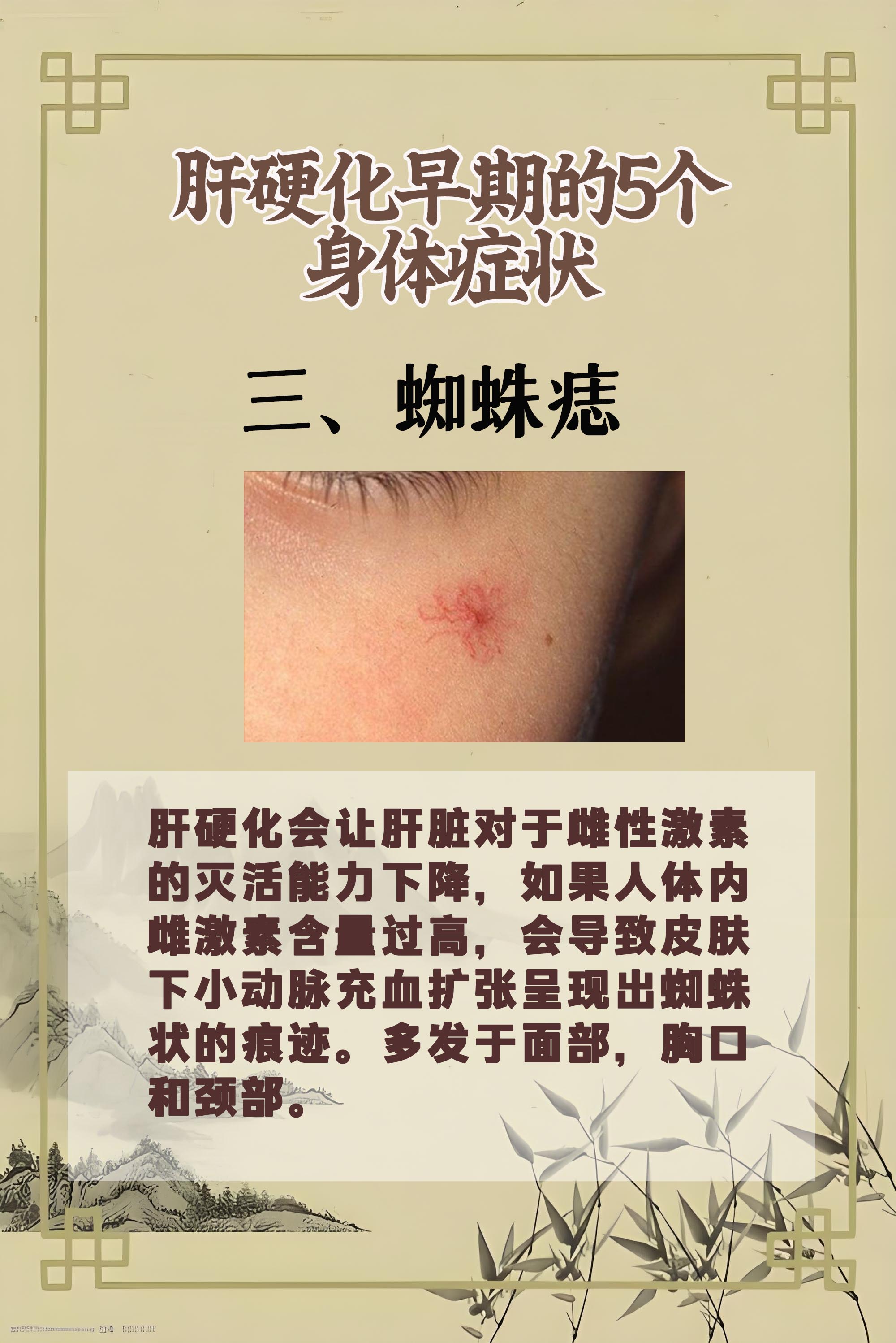 肝腺瘤的产生原因及临床表现