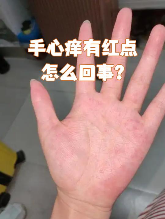 手上红点怎么回事..