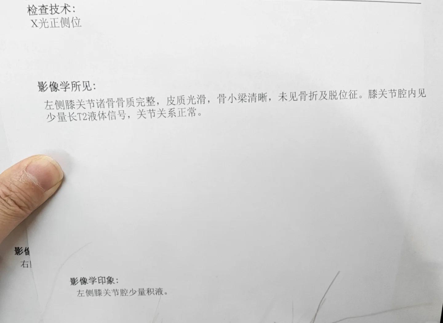 膝盖做核磁共振需要多少钱