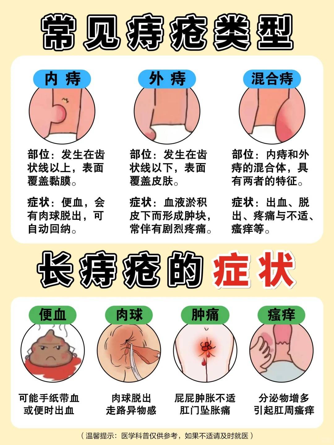 混合痔的症状有哪些?