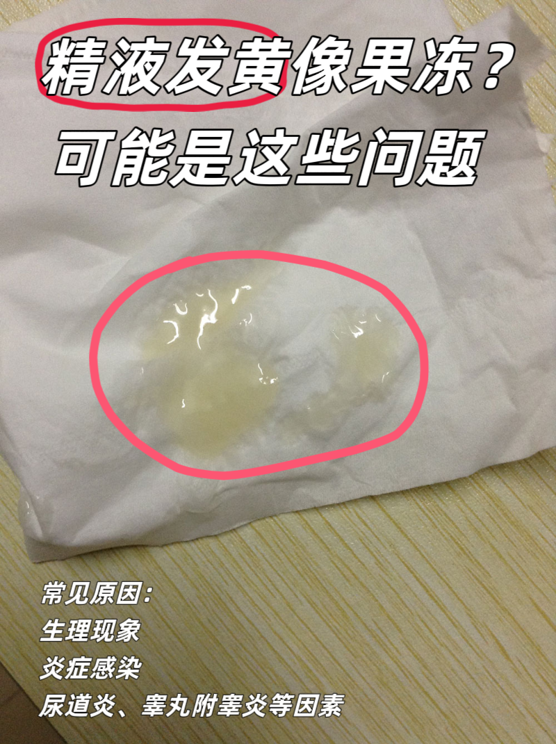 精液是透明的,正常吗