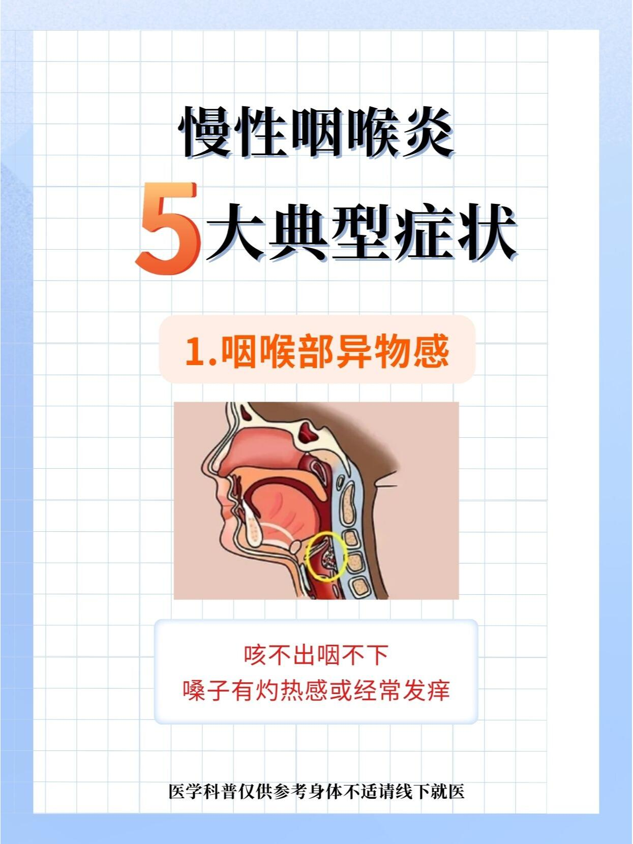 喉咙痒老是咳嗽怎么回事