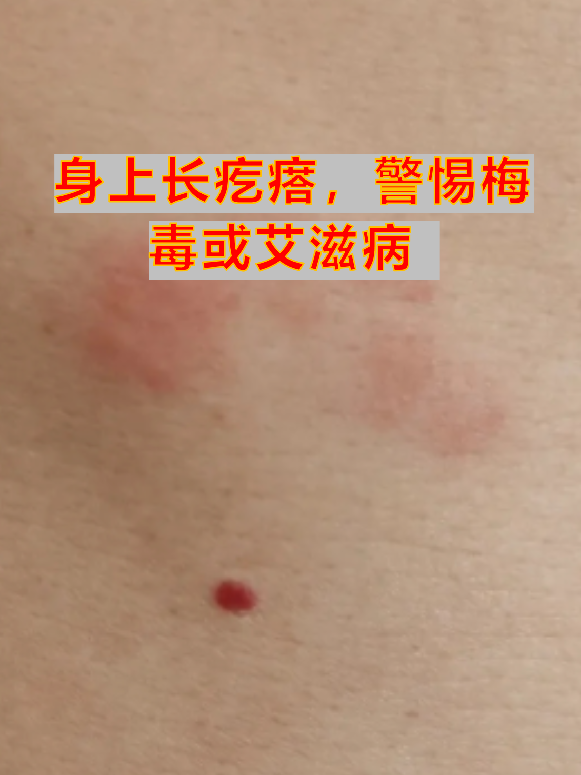 皮肤刺痛感但表面没有异常