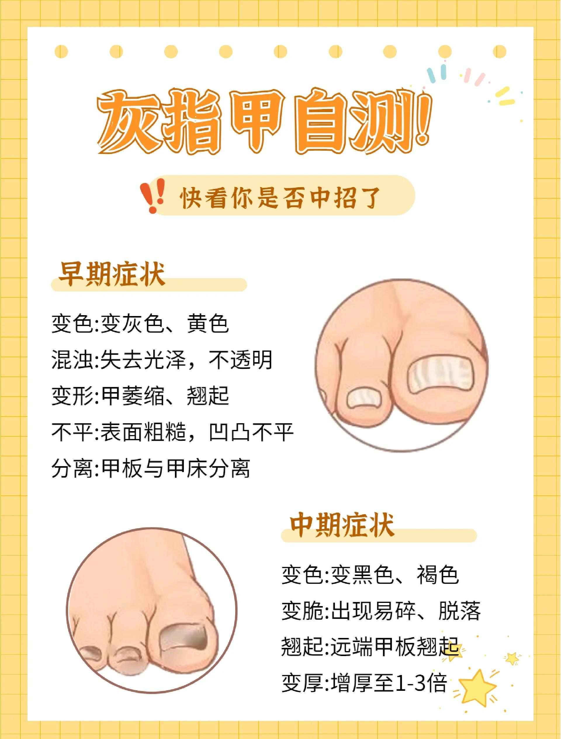 指甲上月牙少怎么办?