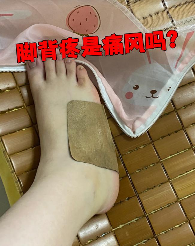 痛风脚背会痛吗