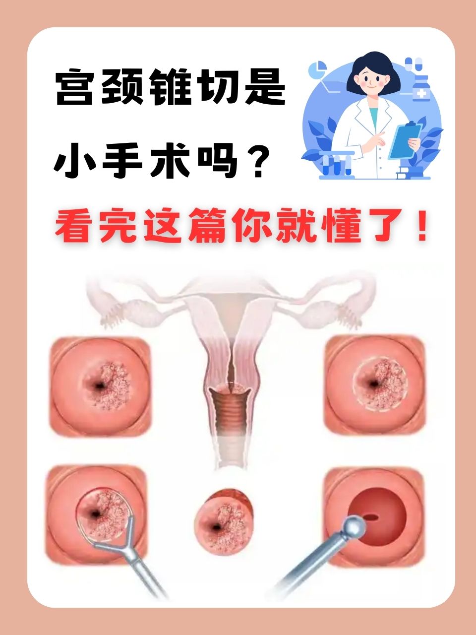 宫颈息肉一定要手术吗