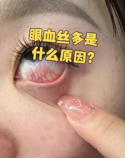 眼睛发黄有血丝为什么?