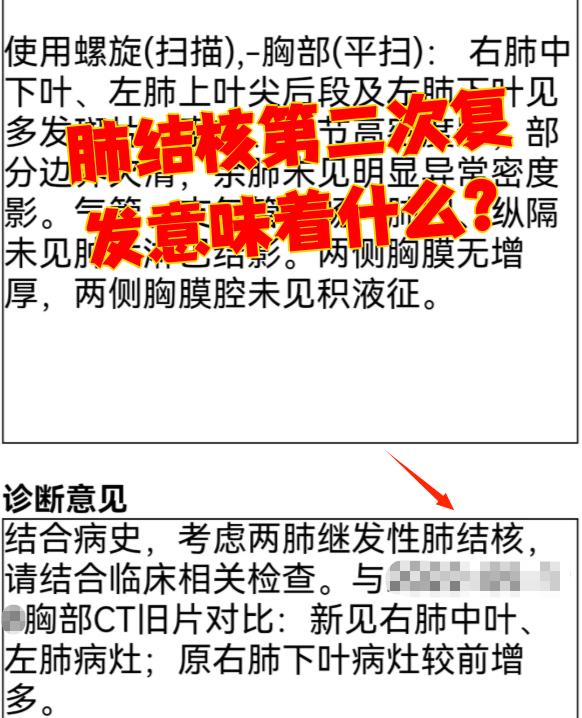 肺结核容易复发吗