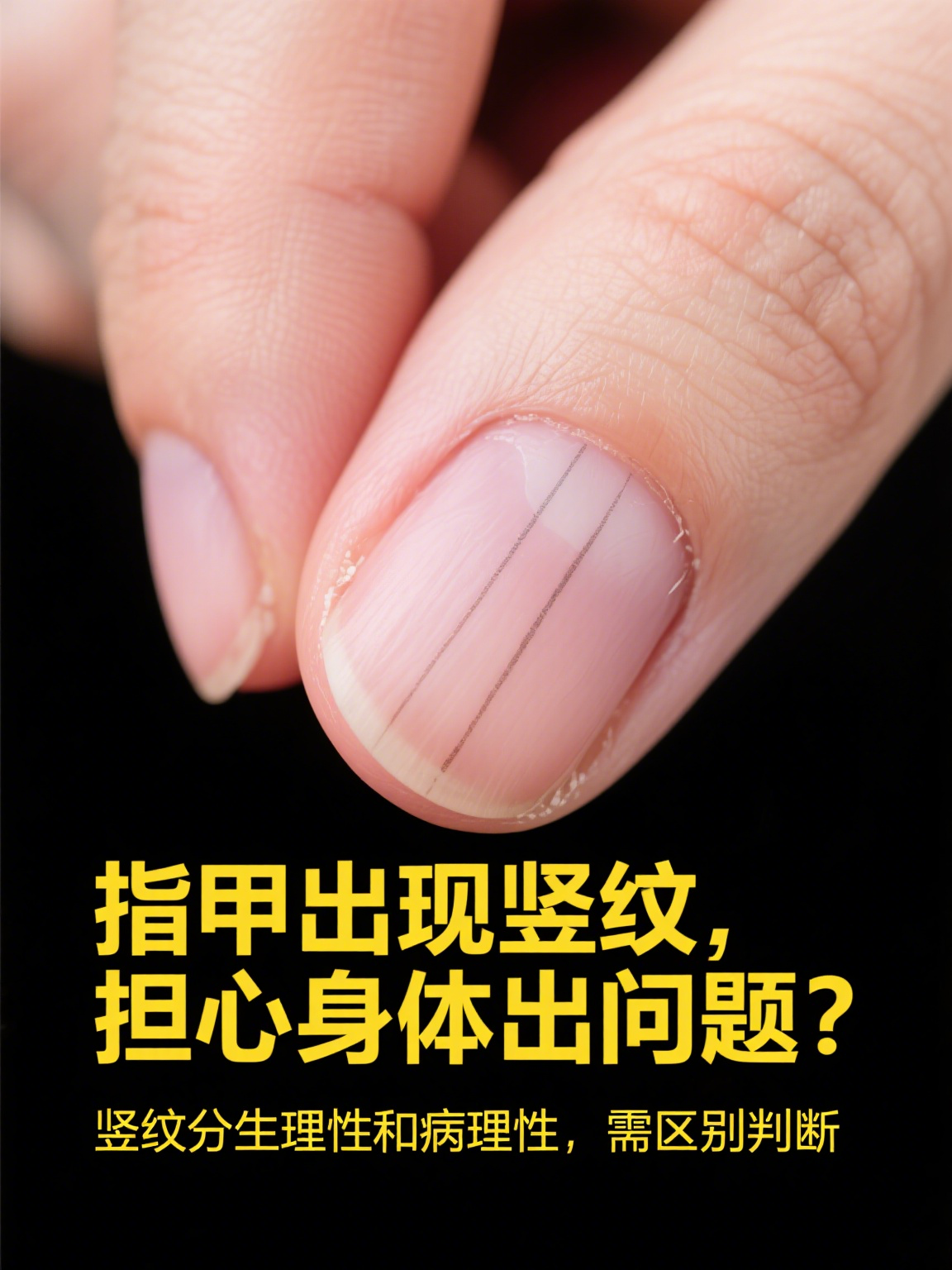 手指甲上有竖纹是什么原因