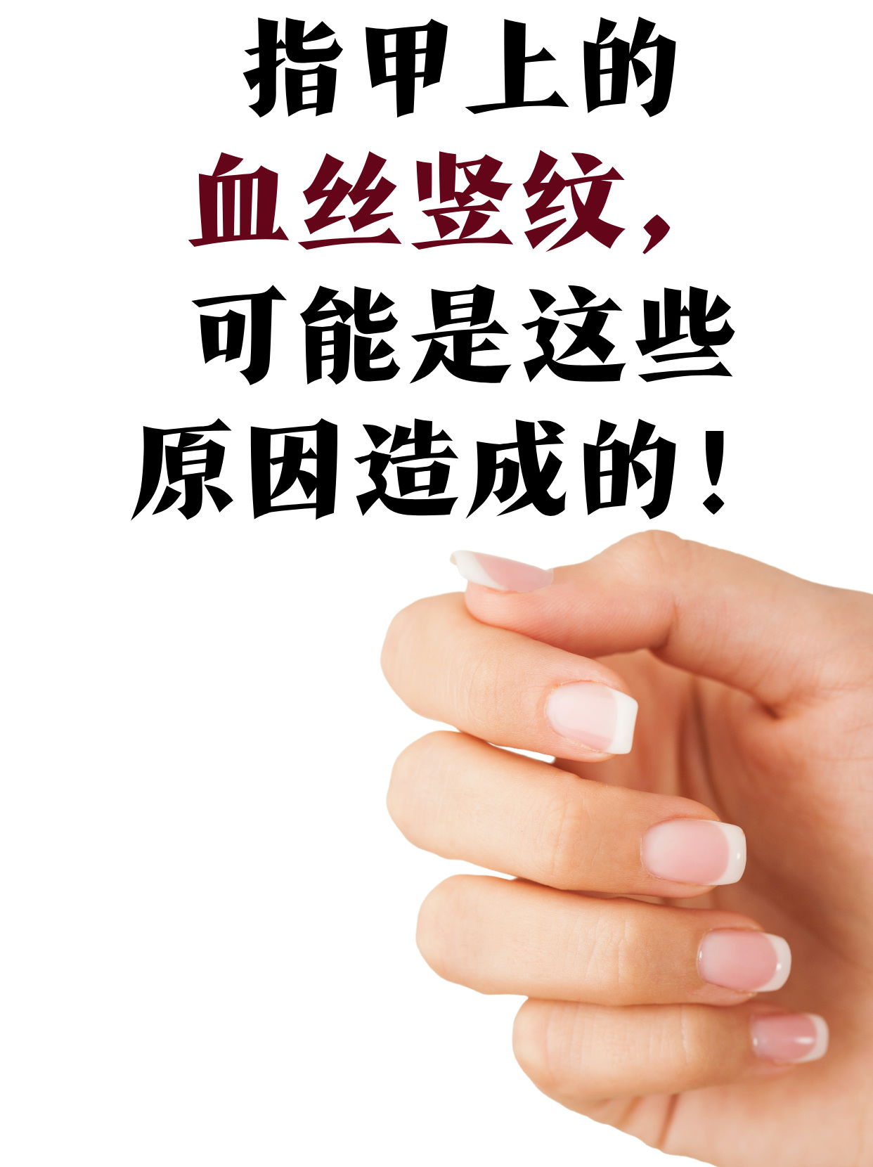手指甲上有竖纹是什么原因