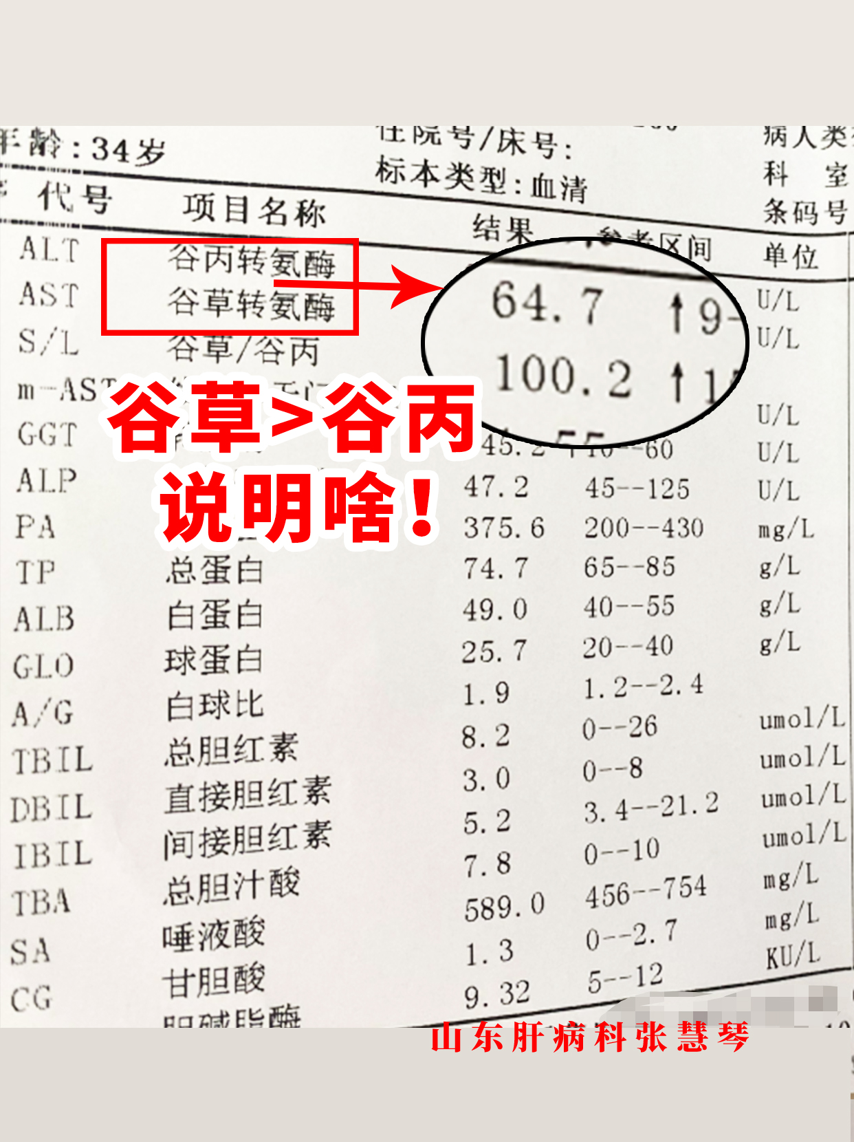 谷丙转氨酶偏高怎么回事