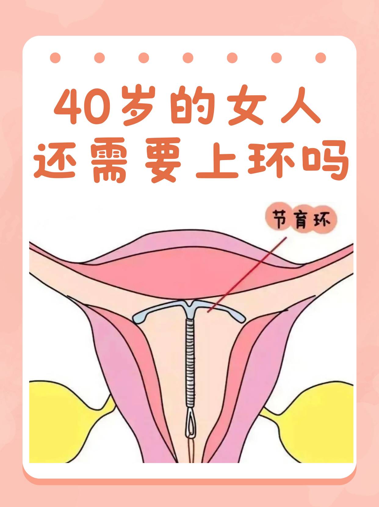 带环有可能会怀孕吗