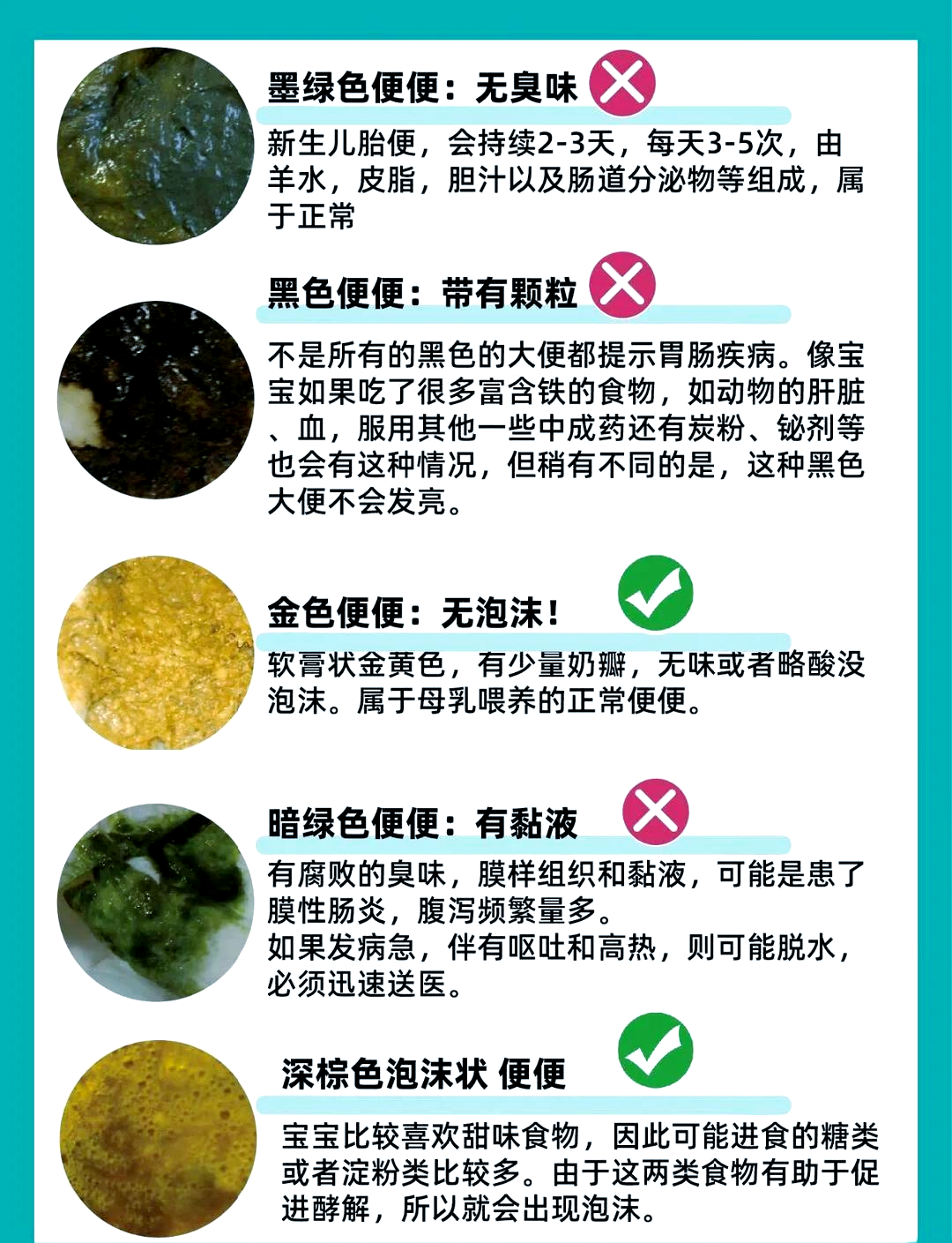 宝宝拉绿屎是怎么回事?