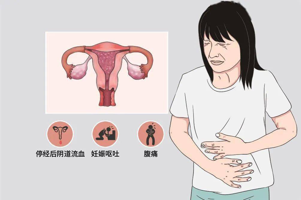 阴道流血但不是月经怎么回事