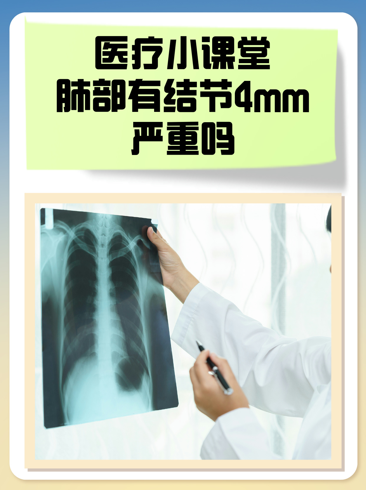 肺结节是怎么引起的