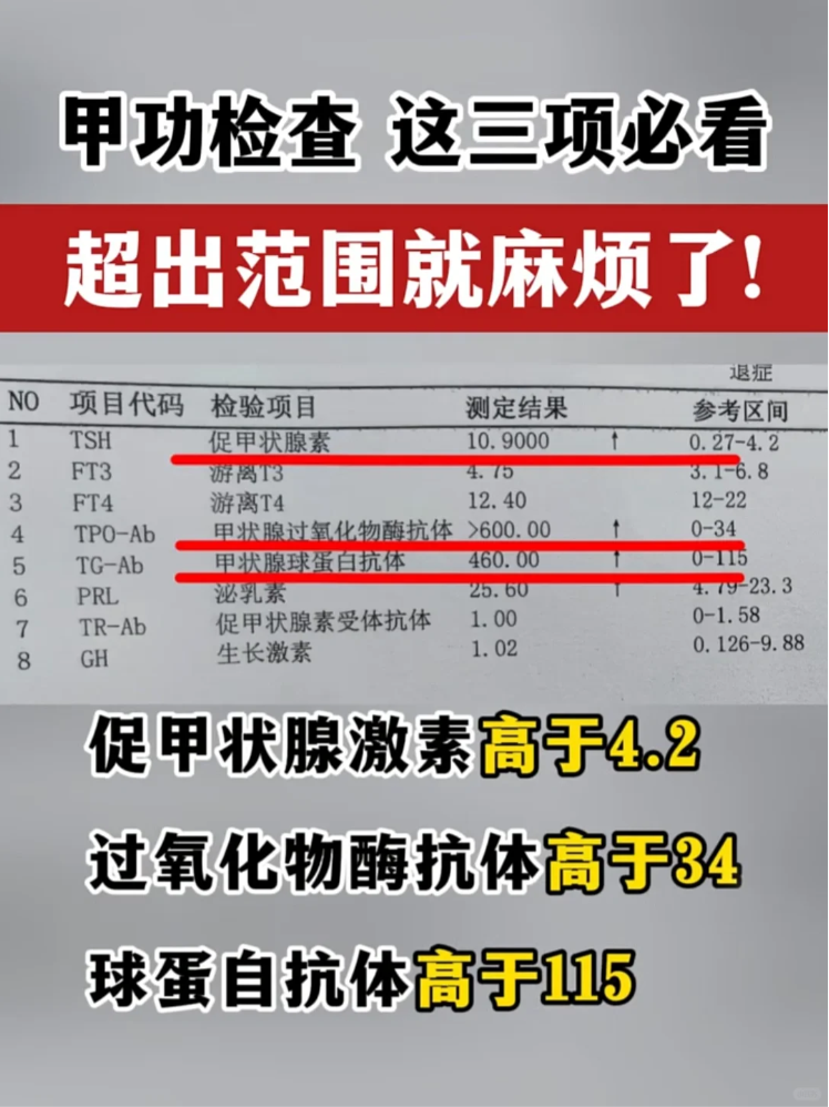 促甲状腺激素高是怎么回事