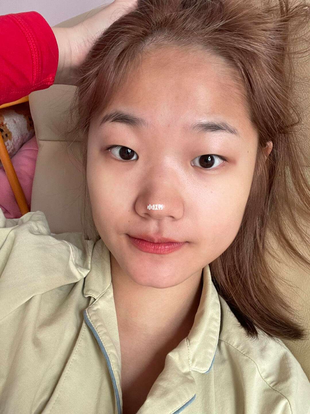 额头发黑是什么原因