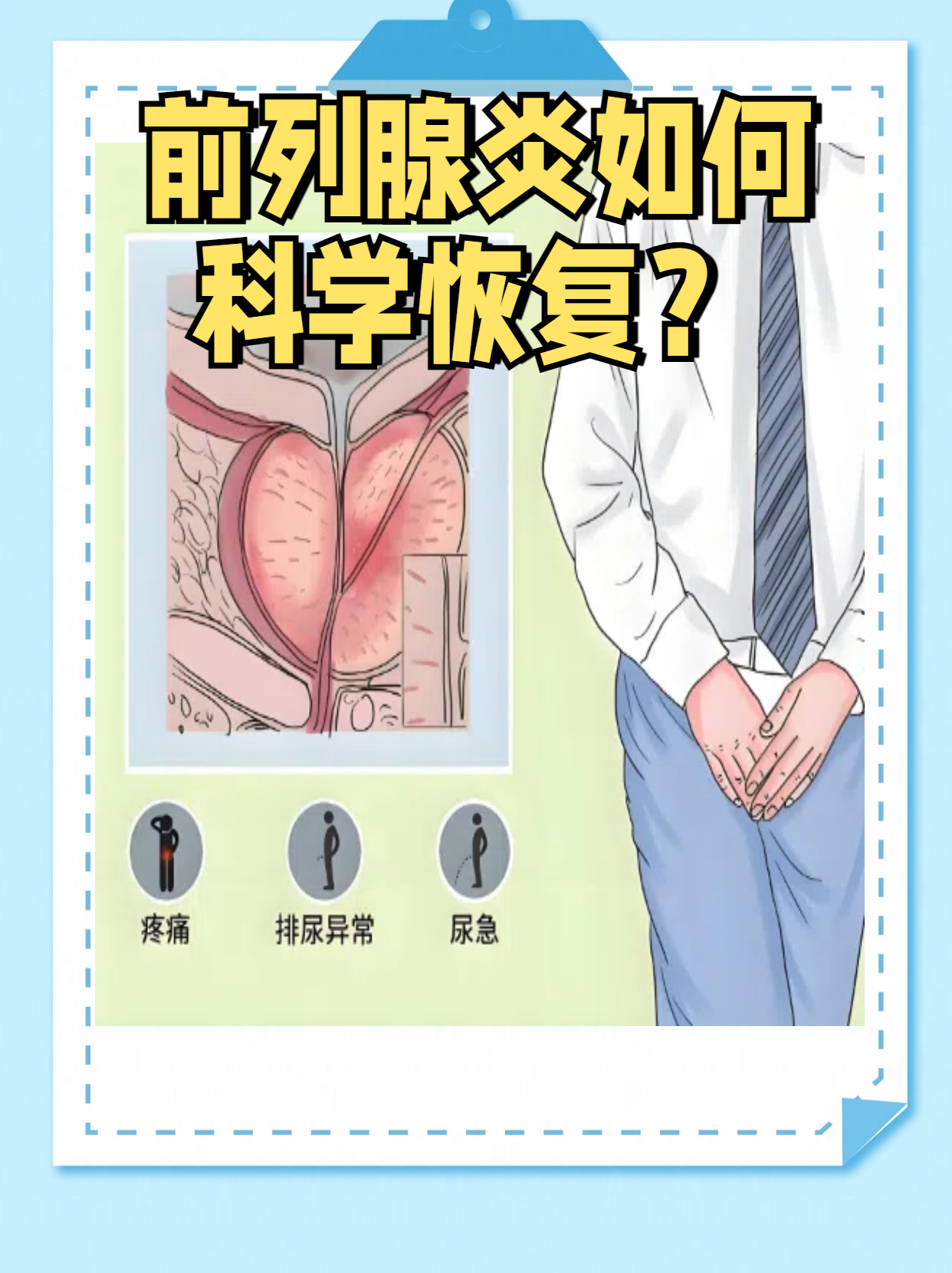 怎么检查前列腺炎吗