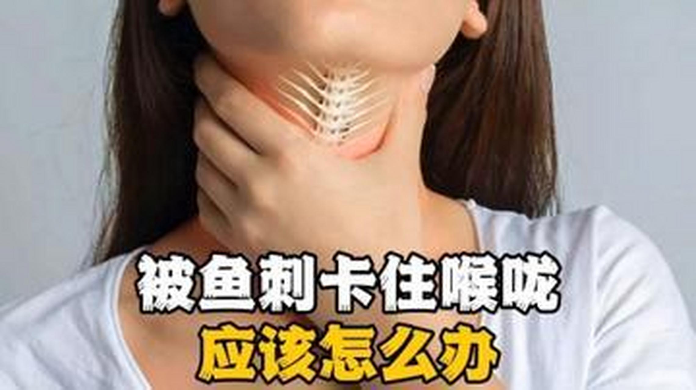 鱼刺卡喉咙几天能消化完?