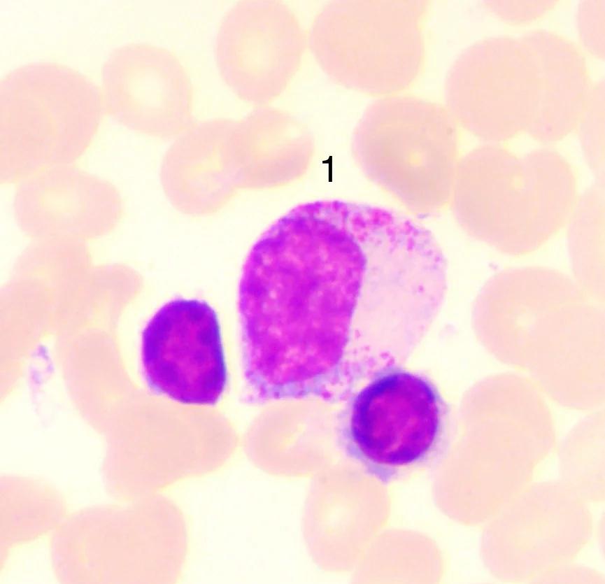 请问中性粒细胞是什么