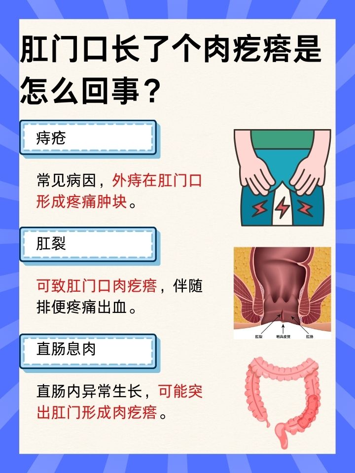 肛门癌的表现主要是什么?