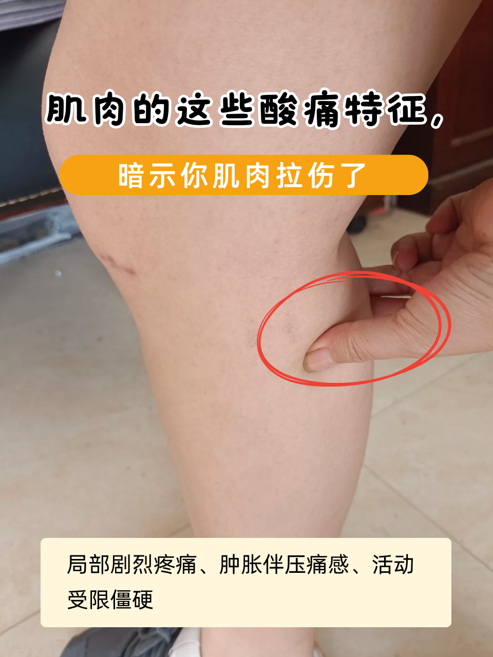 肌肉拉伤是什么感觉?