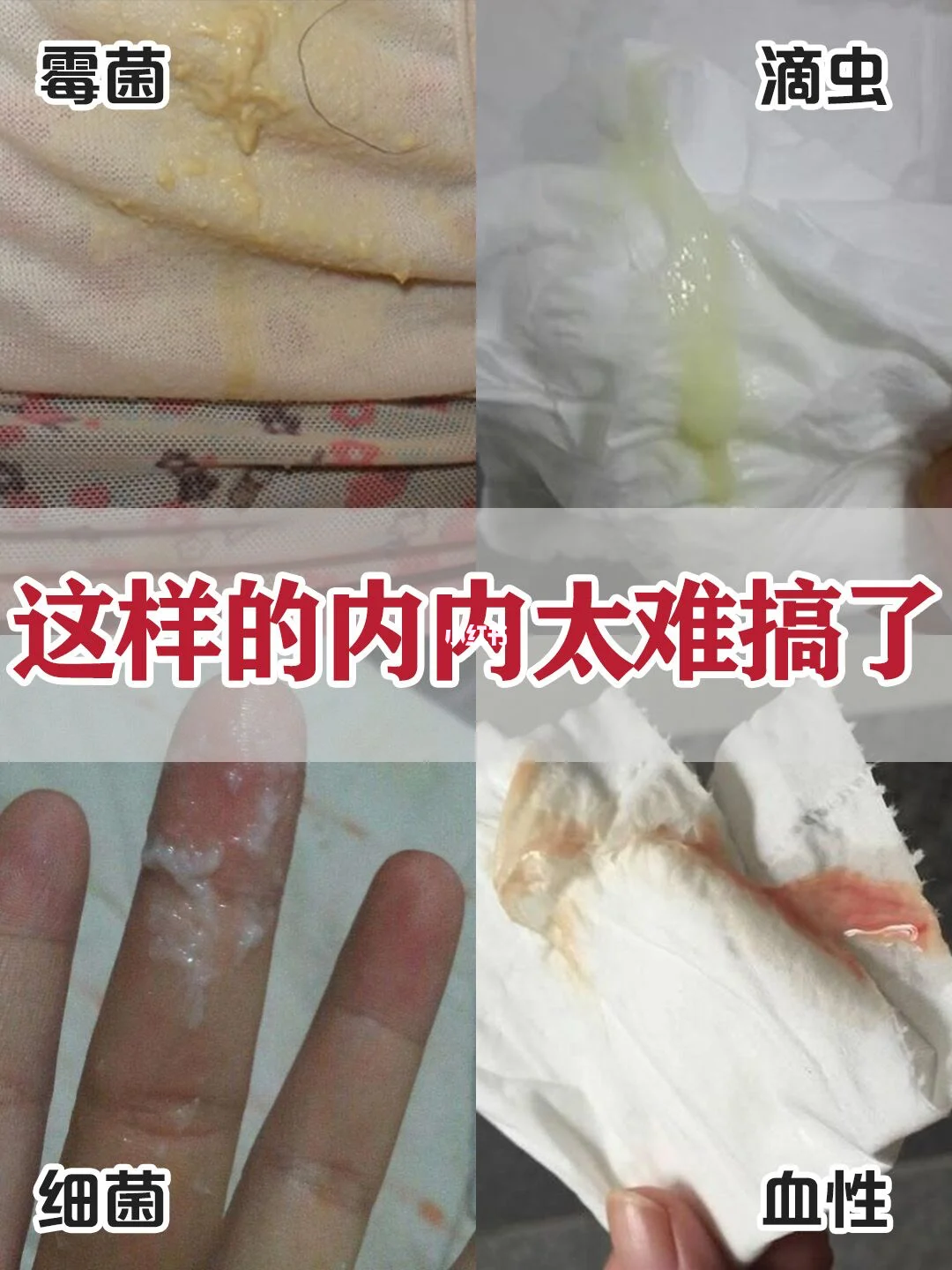 正常白带是什么样的