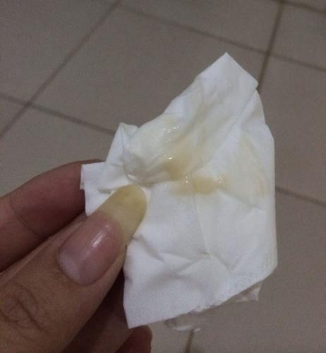 正常白带是什么样的