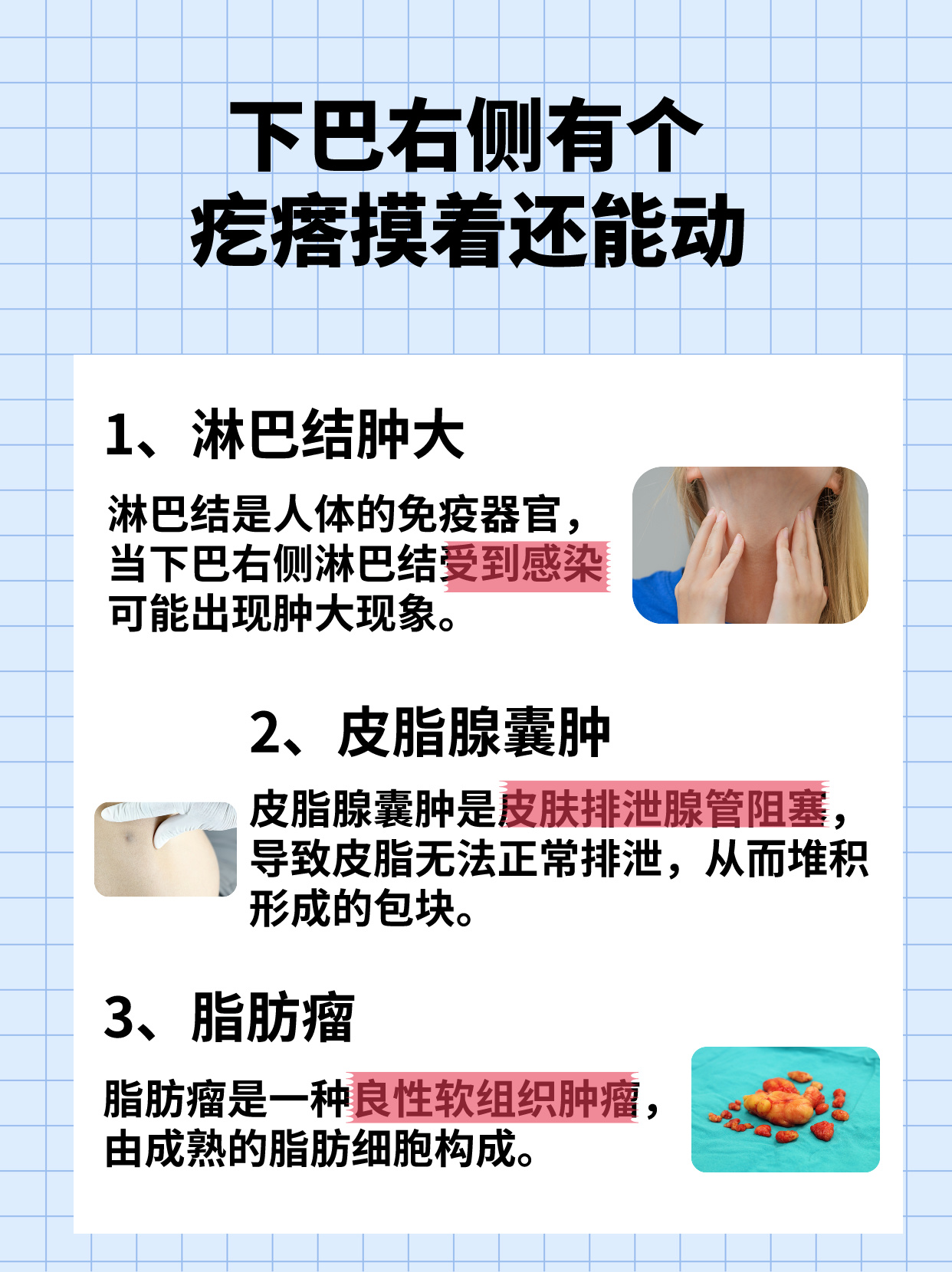 脸上长了个肉疙瘩,怎么治?