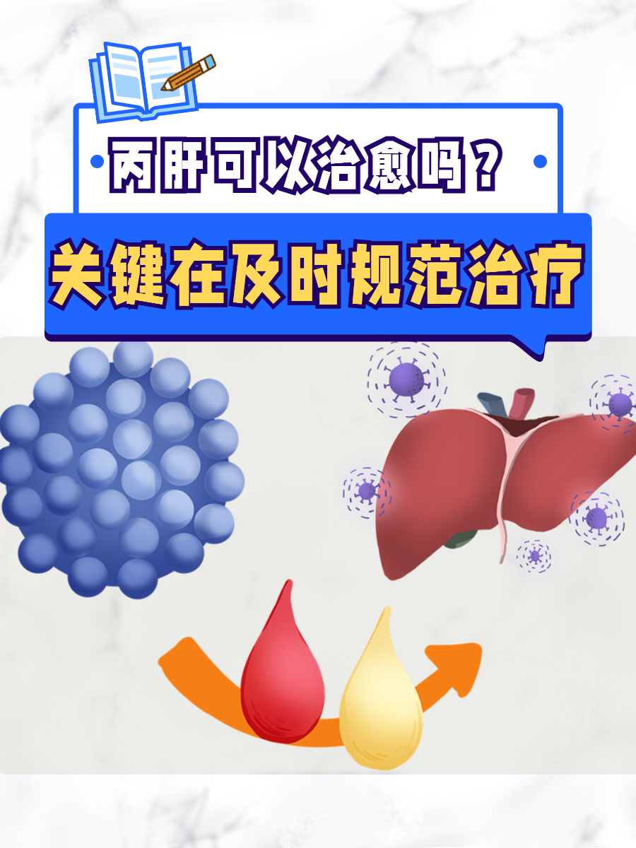 丙肝怎么治疗呢