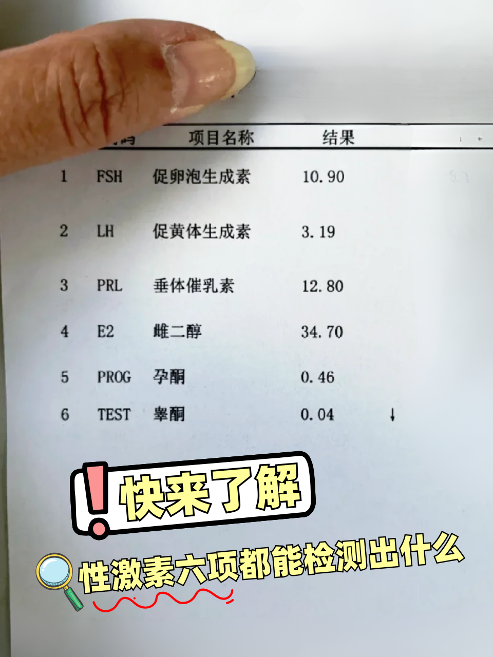 睾酮高影响怀孕吗