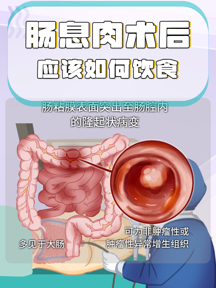 大肠息肉一定要切除吗