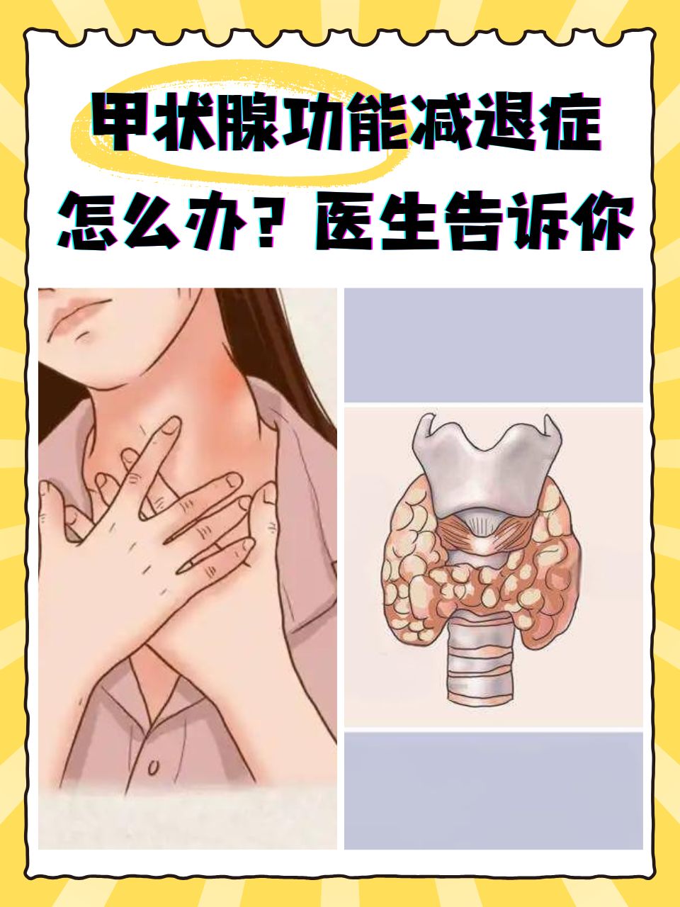 什么叫甲状腺功能异常?