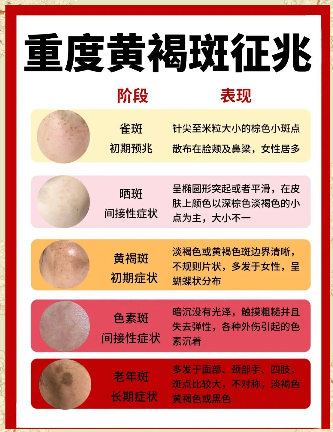 脸上长斑是什么原因导致的,