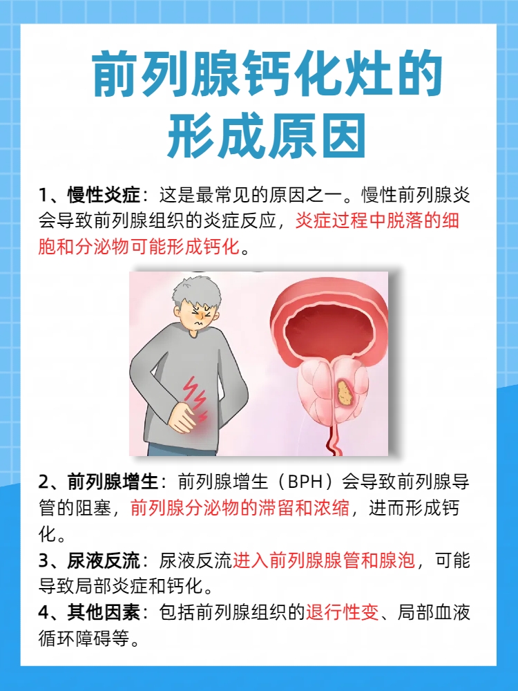 前列腺钙化有几种治疗方法