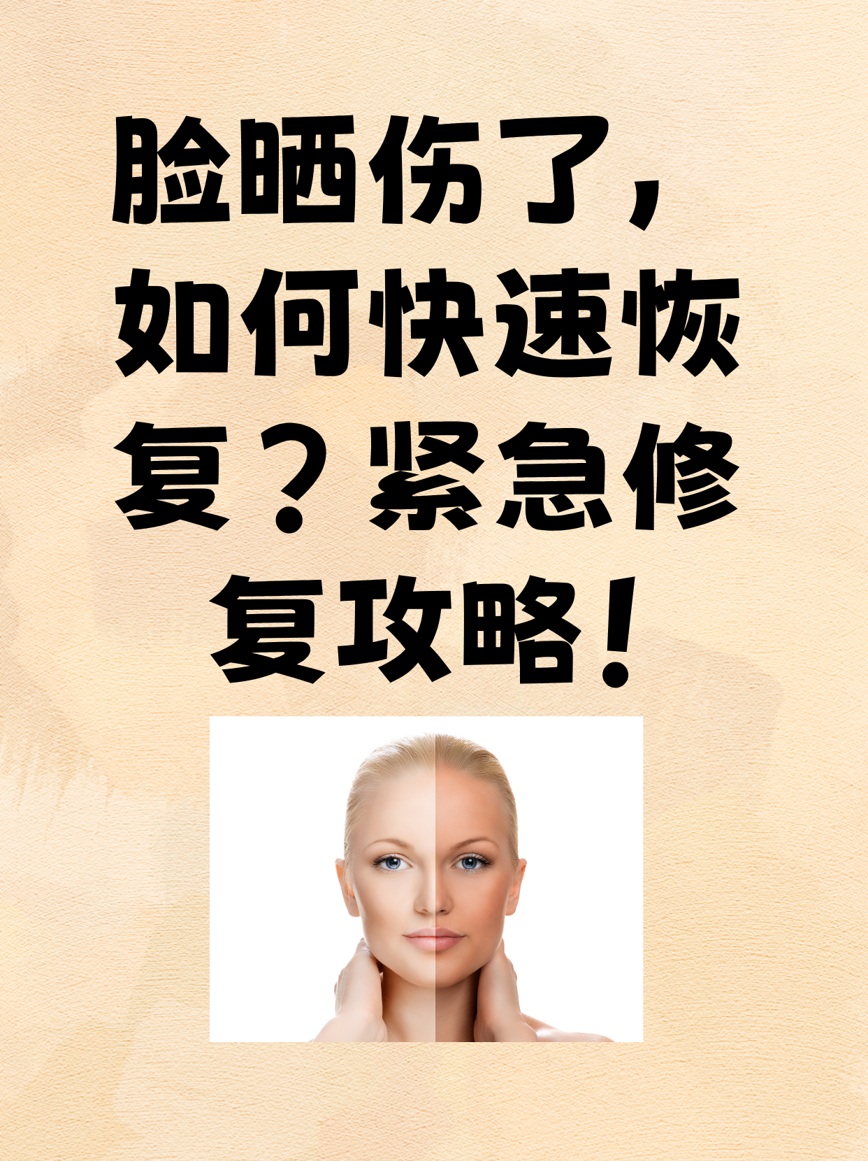 脸部晒伤后怎么办