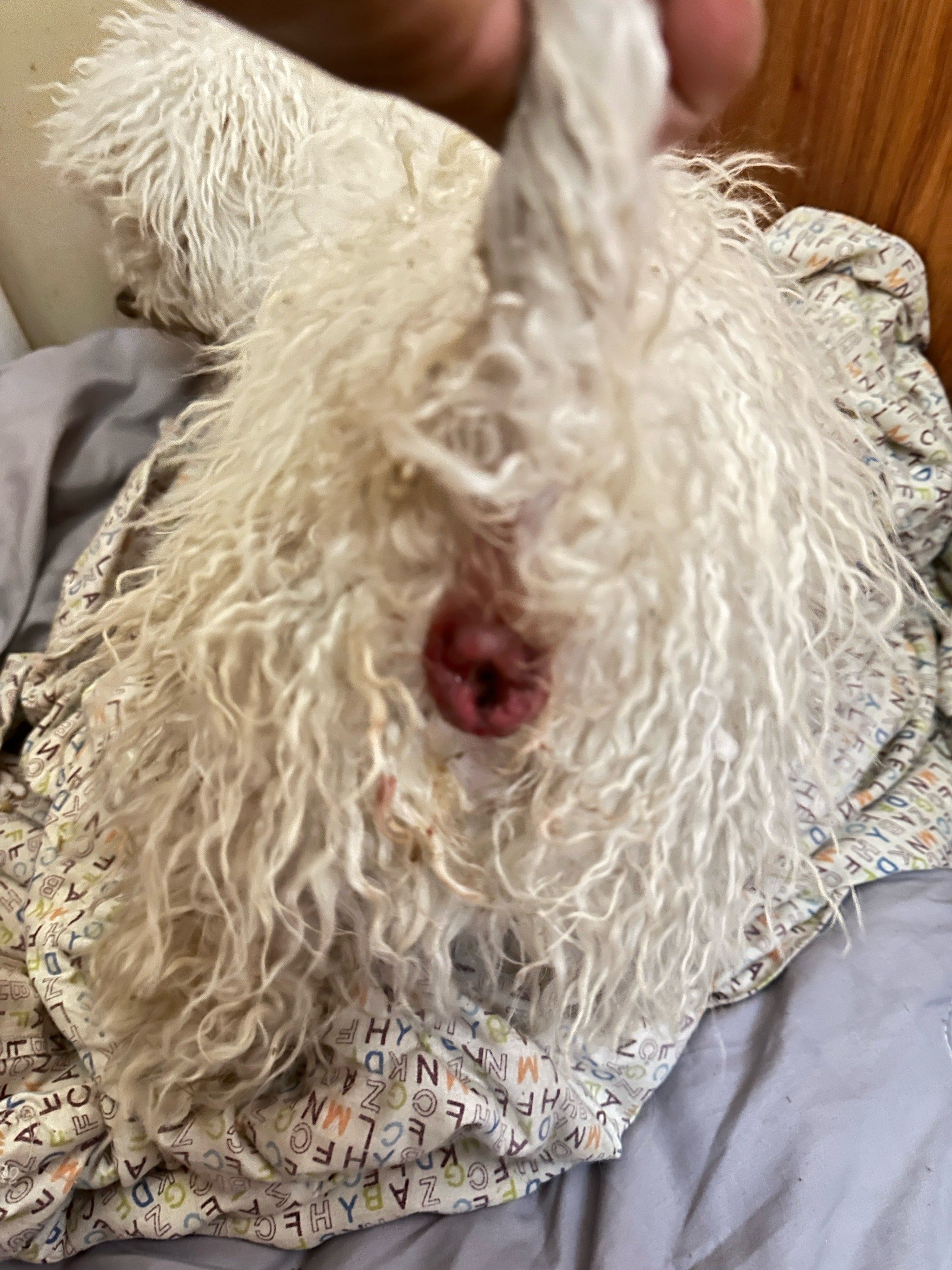 肛裂是什么样子的