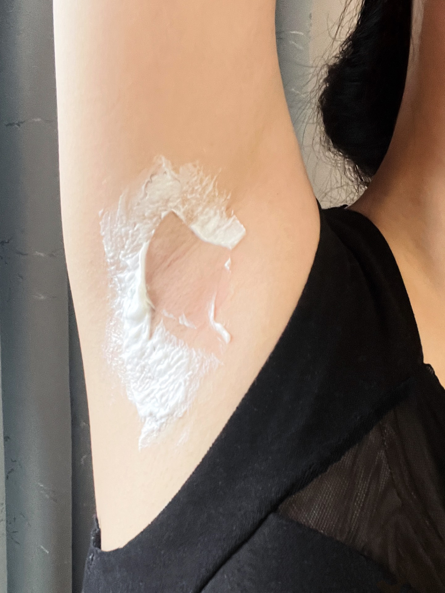 腋毛上面一层黄色的是什么?