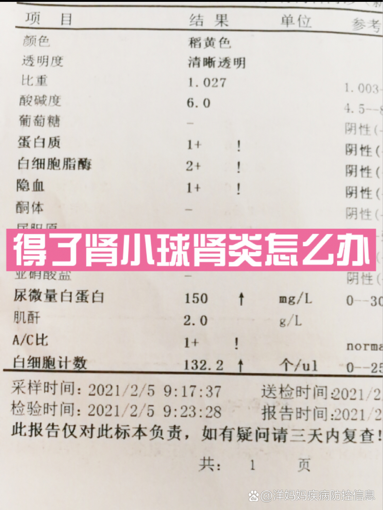 什么是慢性肾小球肾炎