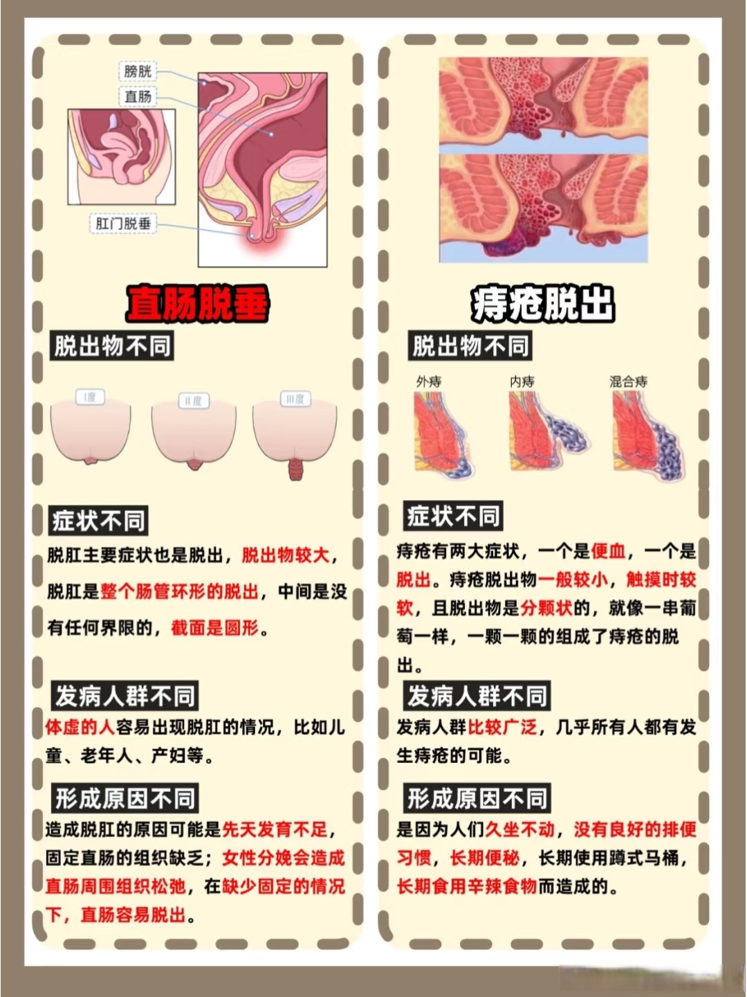肛裂和痔疮哪个更严重?