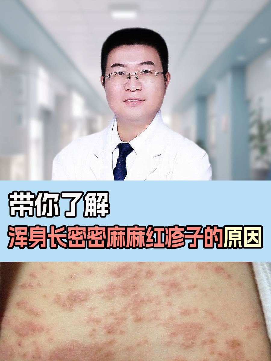 皮肤红疹怎么办呢