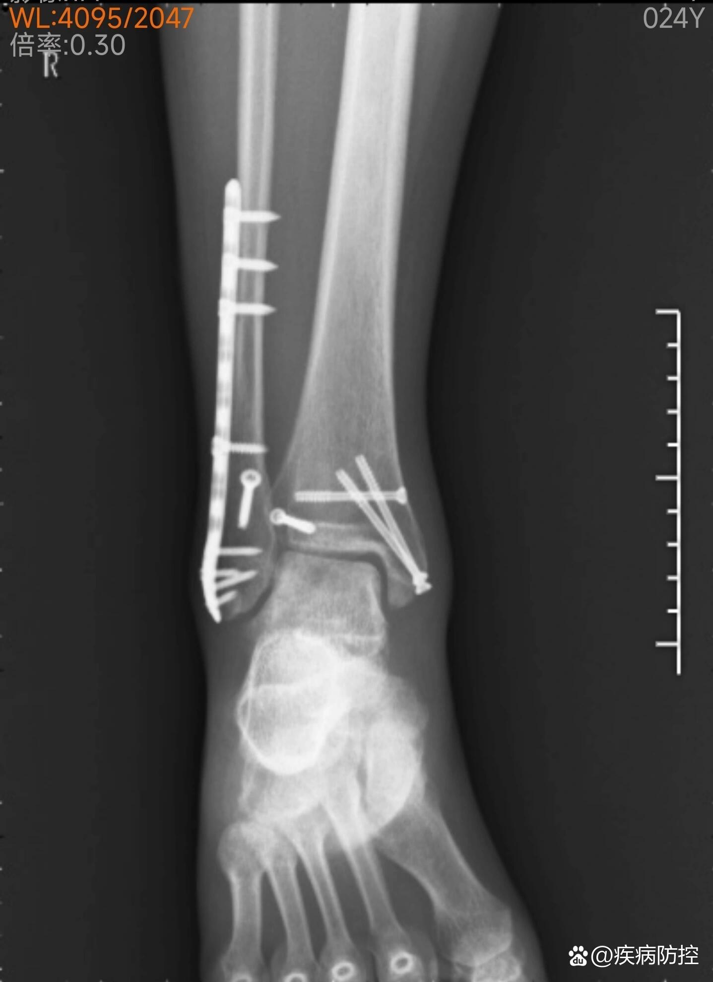 2025年12月4日 第4页
