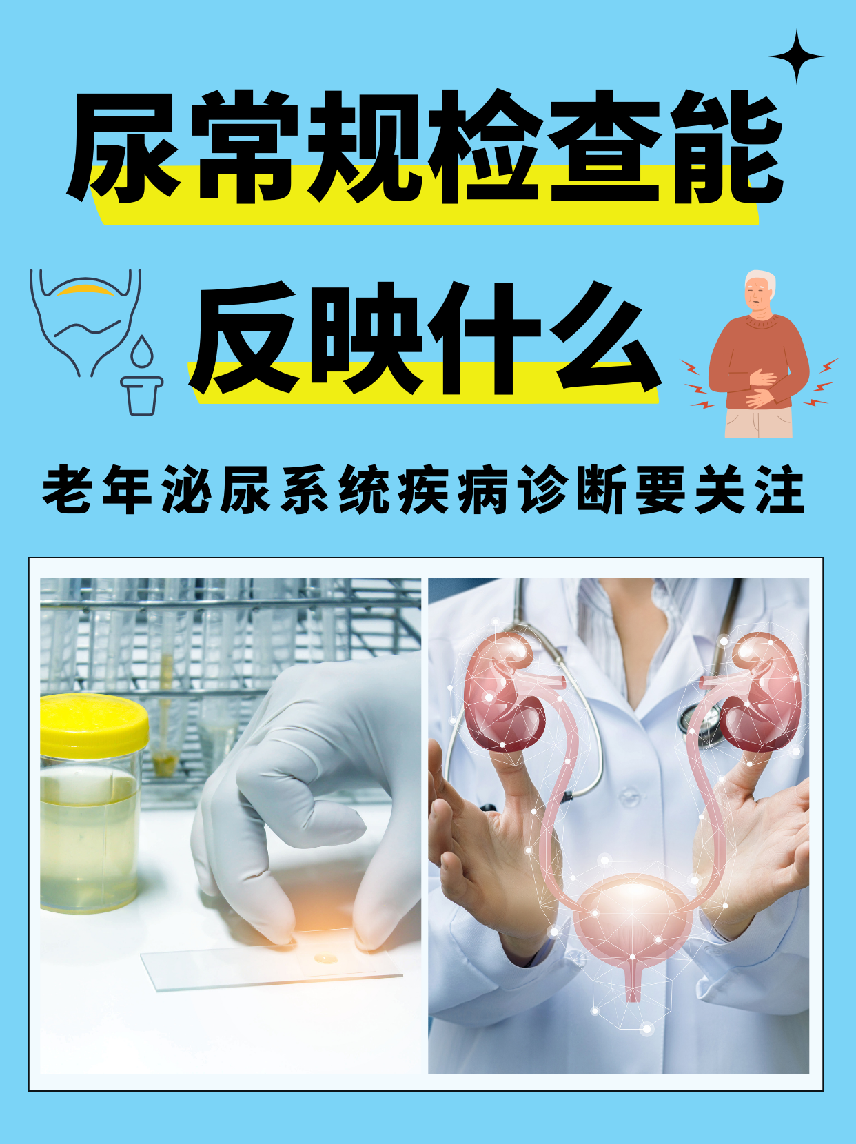 尿常规能检查出什么