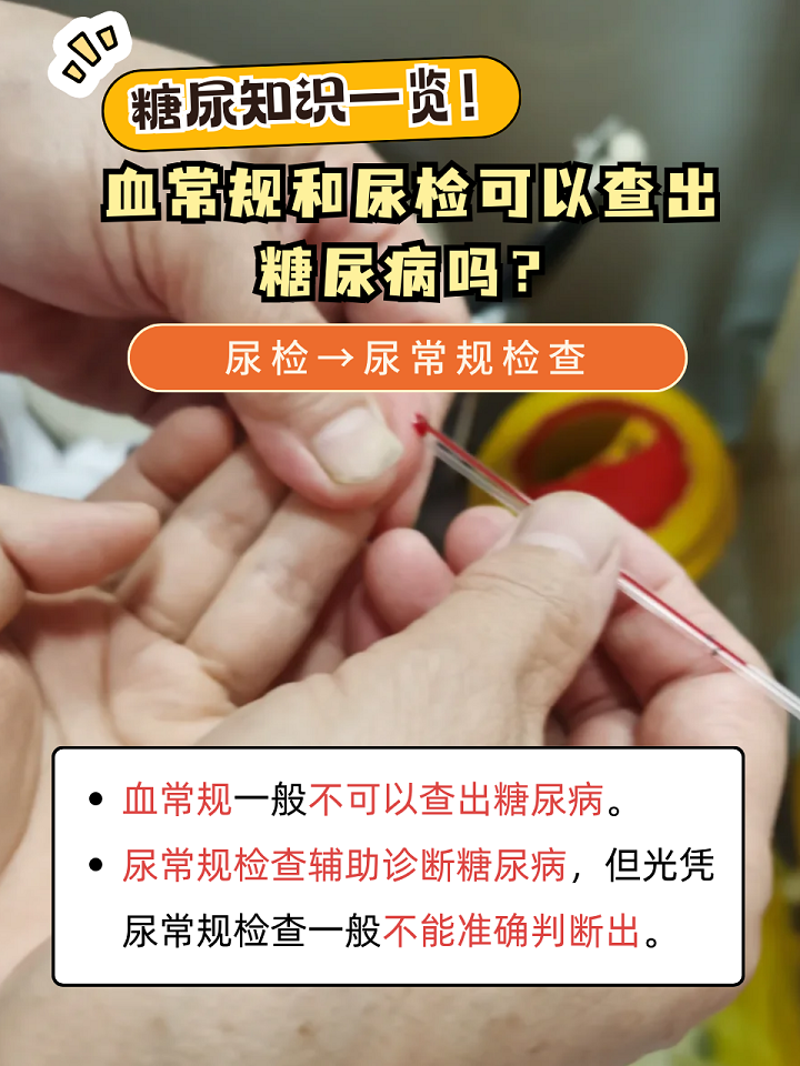 糖尿病挂什么科