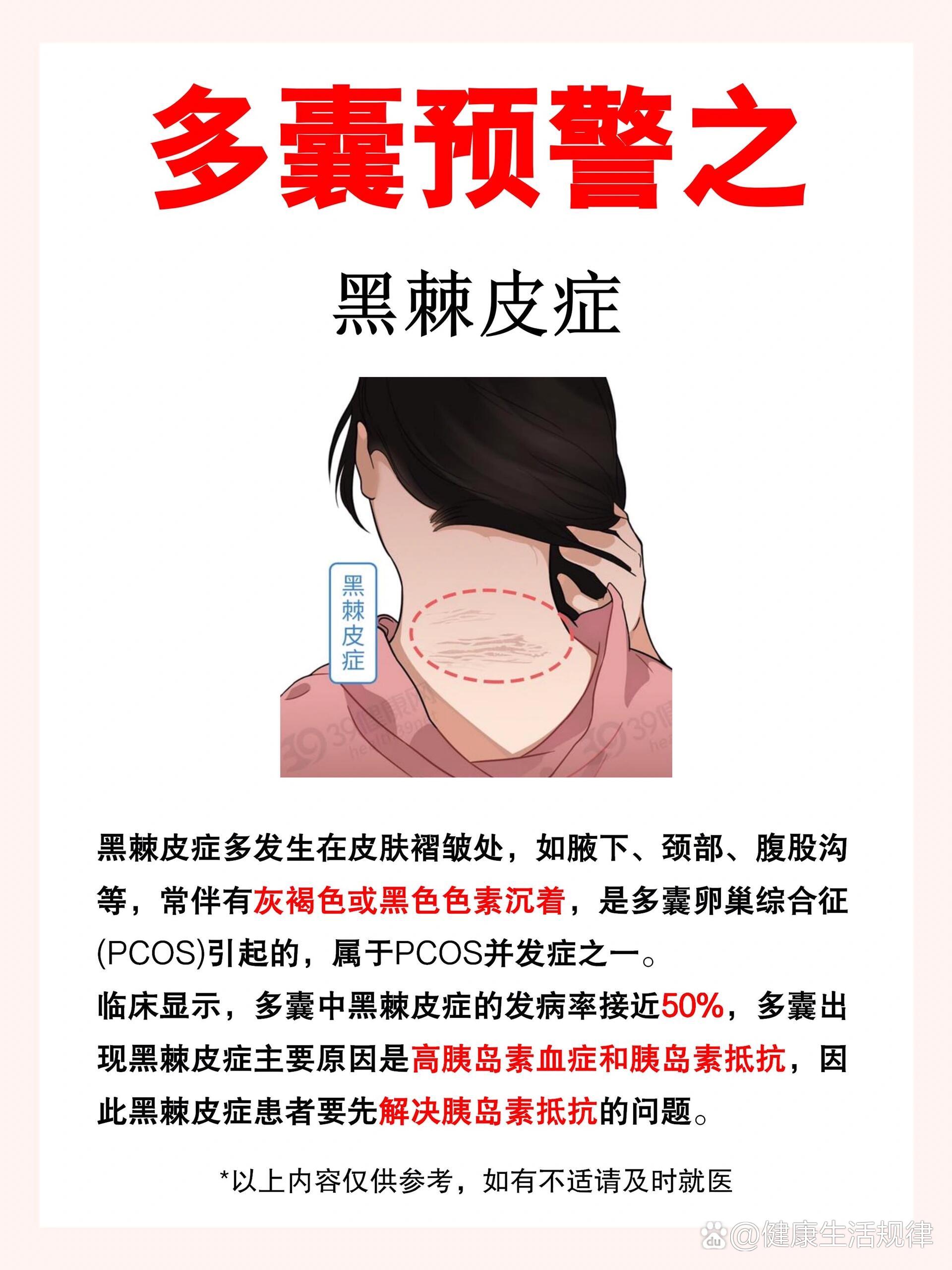 黑棘皮病怎么治疗