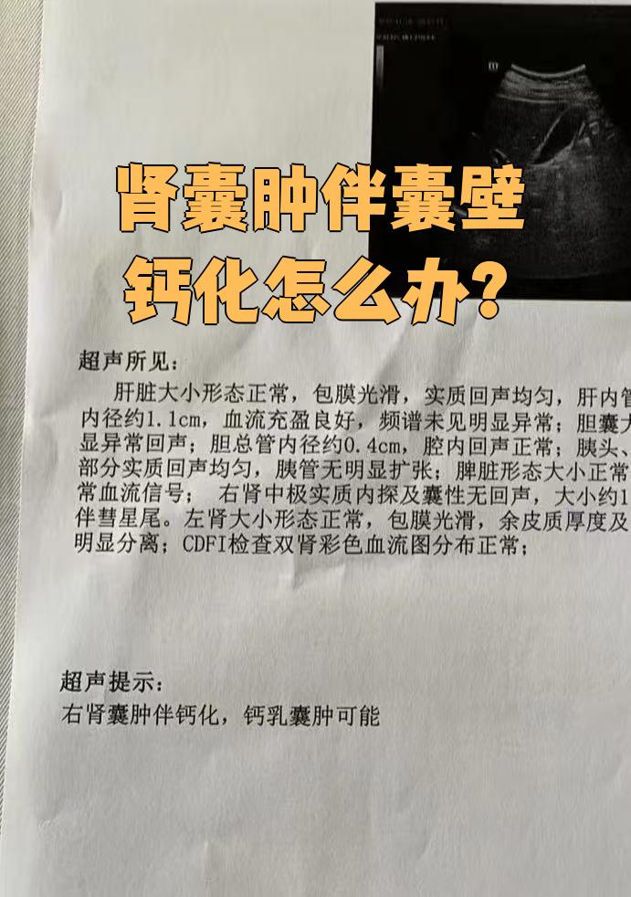 右肾囊肿是怎么回事?