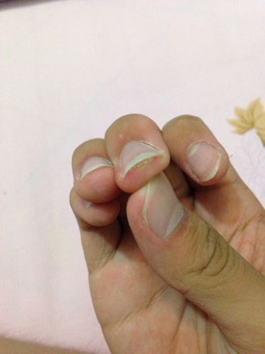 医生您好,请问吃兴奋剂可以跑的更快,提高