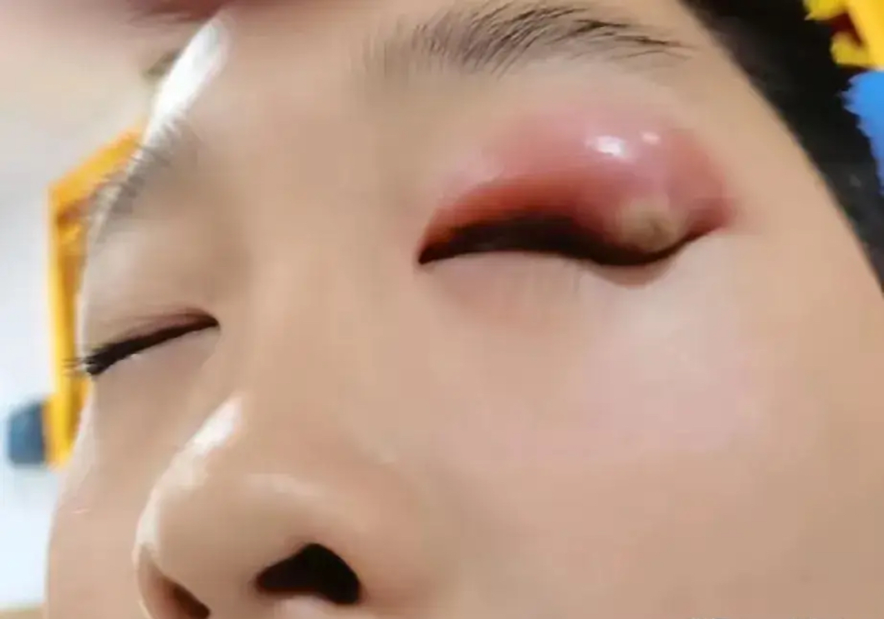 眼睛突然像针扎一样的疼